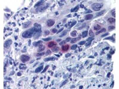 Immunohistochemistry: MLF1 Interacting Protein [p Thr78] Antibody [NBP1-77938]